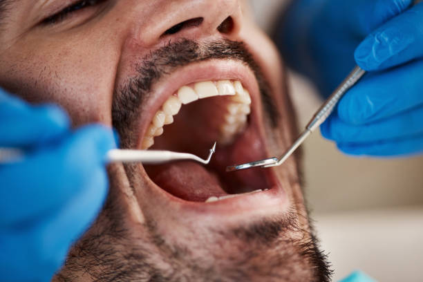 Best Emergency TMJ Treatment in Burns, OR